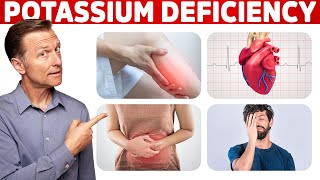 Low Potassium Signs Symptoms Causes and Treatment [upl. by Akimehs249]