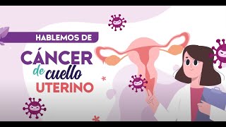 Hablemos del cáncer de cuello uterino [upl. by Platt708]