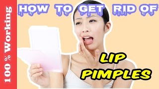 How To Get Rid Of Pimples On Lips Overnight  Fast  Home Remedies  Blackheads  Acne  Remove [upl. by Pelagias828]