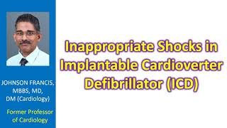 Inappropriate shocks in implantable cardioverter defibrillator ICD [upl. by Brendin]