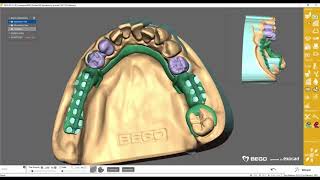 WIRONIUM® RP Hybrid VideoTutorial [upl. by Thetisa]