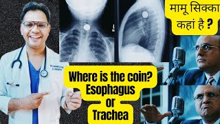 coin in chest Xray Trachea or Esophagus radiology ENTneet [upl. by Qirat]