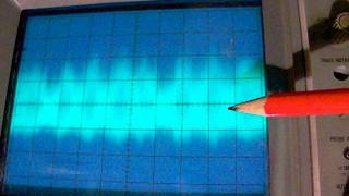 oscilloscope views inside a superheterodyne shortwave radio receiver [upl. by Friedland796]