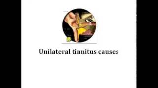 causes of tinnitus [upl. by Hoopes641]