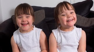 Down’s Syndrome Twins Are One In A Million [upl. by Nomelif]