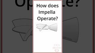 HOW DOES IMPELLA OPERATE PHYSICS impella [upl. by Aan375]