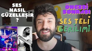 SES NASIL GÜZELLEŞİR  GERİLİM TRAVMASINI NASIL ÇÖZDÜK   ÖNCESİ SONRASI [upl. by Giavani]