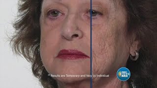 Plexaderms serum promises to reduce age lines and wrinkles  Sponsored [upl. by Fast]