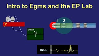 Intro to Intracardiac Electrograms amp the EP Lab [upl. by Marcile]