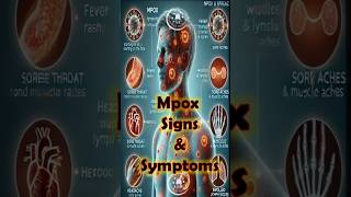 Mpox Alert Vital Symptoms amp MustKnow Facts to Protect Yourself MpoxSymptoms healthalert [upl. by Teragram]