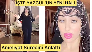 İŞTE YAZGÜL’ÜN YENİ FİZİĞİ Karın Germe Amelliyatı [upl. by Merril23]