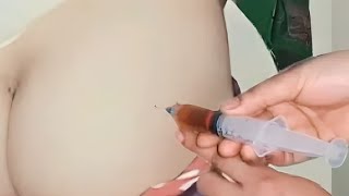 How to Give an IM Intramuscular injection in the Buttocks  Dorsogluteal hip Technique 👨‍⚕ [upl. by Aicargatla169]