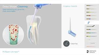 ProTaper Ultimate Endo File System  Cleaning Sequence [upl. by Nauaj]