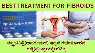 TREATMENT OF FIBROID UTERUSMEDICINES TO SHRINK FIBROIDMYOMECTOMY AND UTERINE ARTERY EMBOLIZATION [upl. by Lefton]