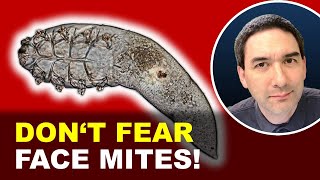 FACE MITES really do live in you  Demodex causing rosacea [upl. by Ardnat]