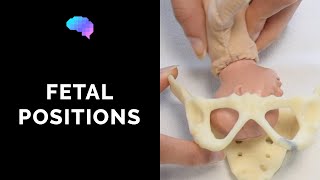 Types of Fetal Positions  OSCE Guide  UKMLA  CPSA [upl. by Ellimaj]