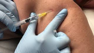 Punch Skin Biopsy  Skin Cancer Test [upl. by Aes]