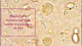 Blastocystis hominis parasite under microscope at 40X [upl. by Dove]