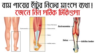 বাম পায়ের হাঁটুর নিচের মাংসে ব্যথা জেনে নিন সমাধান Leg pain treatment [upl. by Nicodemus508]