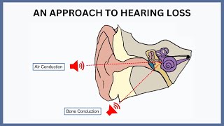 An Approach to Hearing Loss [upl. by Hsirap]