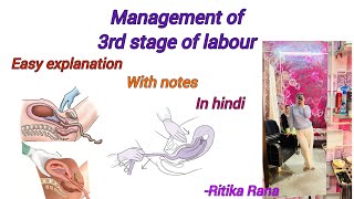 Management of 3rd stage of labour  AMTSLactive management of 3rd stage   expectant management [upl. by Langsdon]