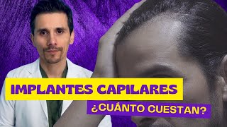 implantes capilares ¿Cuánto cuesta [upl. by Sinnard916]