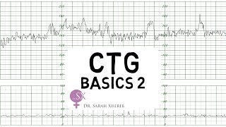 CTG Basics Part 2  Decelerations amp Fetal Physiology [upl. by Hynes688]