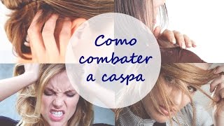 🔴Como Combater a Caspa com Produtos Caseiros [upl. by Ajad]