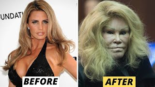 Jocelyn Wildenstein The Golden Lion Before and After Plastic Surgery [upl. by Einre622]