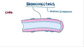 Bronchiectasis [upl. by Hoban]