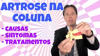 Artrose na coluna o que é quais sintomas e como tratar artrose na coluna lombar e cervical [upl. by Merdith]