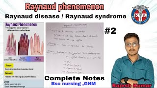 Raynaud phenomenon raynaud diseasesyndromeINTEGUMENTARYPROBLEMS BSCNURSING AND GNMrknursingpoint [upl. by Giulietta]