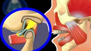 Should Jaw Cracking be treated [upl. by Ola510]