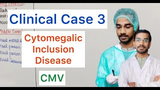 Clinical Case 3  Cytomegalic Inclusion Disease  CMV [upl. by Nosreip]