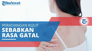 Eksim Atopik Peradangan pada Kulit yang Menyebabkan Munculnya Rasa Gatalgatal [upl. by Odey]