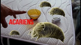 Les acariens  de nouveaux acteurs dans les maladies inflammatoires intestinales  video abstract [upl. by Bevon432]