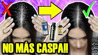 EL MEJOR SHAMPOO PARA LA CASPA  MARIEBELLE COSMETICS [upl. by Ellehc]