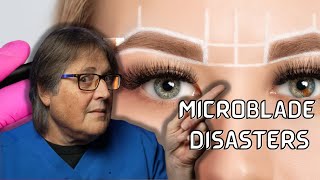 Before Removing Microblade Eyebrows With Lasers Watch This  A Doctor Explains [upl. by Attegroeg679]