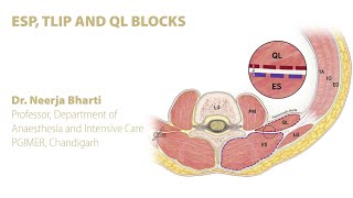 ESP erector spinae plane TLIPthoracolumbar interfascial plane AND QL BLOCKS [upl. by Philender]