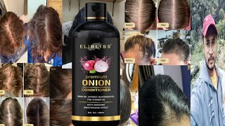 Elibliss Premium Onion Conditioner  Honest Review [upl. by Cogswell]