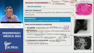 Neumología  12 MICOSIS PULMONARES [upl. by Nnylyam323]