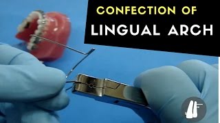 CONFECTION OF LINGUAL ARCH [upl. by Lednew]