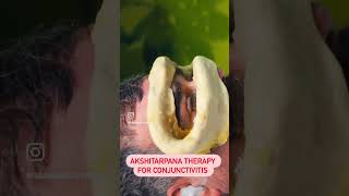 AKSHITARPANA FOR CONJUNCTIVITIS CGHS Empaneled Hospital [upl. by Larred361]