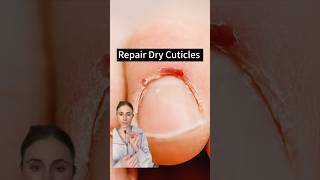 Revive Your Nails Fixing Damaged Cuticles [upl. by Cheffetz]