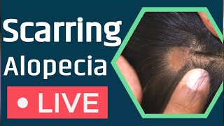 What is Scarring Alopecia Solution Of Scarring Alopecia6 [upl. by Rogergcam]