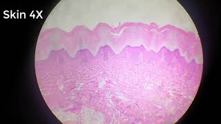 stratified squamous epithelium [upl. by Anaibib]