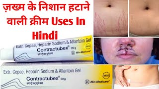 Contractubex 20g Cream Uses in Hindi  Stretch Marks Scar Removal Cream [upl. by Atorod]