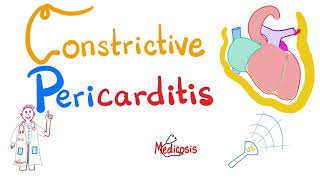 Constrictive Pericarditis  Causes Symptoms Signs Diagnosis amp Management  Cardiology [upl. by Sternberg]