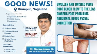 Struggling with Vein Issues Connect with a SuperSpecialist for Effective Treatment doctor [upl. by Aniratak]