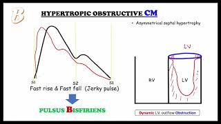 PULSE basics amp ABCD pulse  Internal medicineCardiology focused on FMGENEXT amp NEETPG [upl. by Araek]